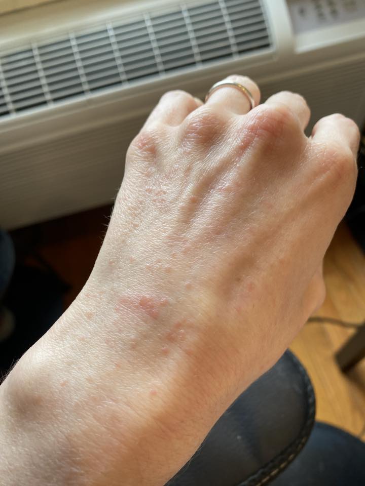 Curious if this looks like eczema or some kind of contact