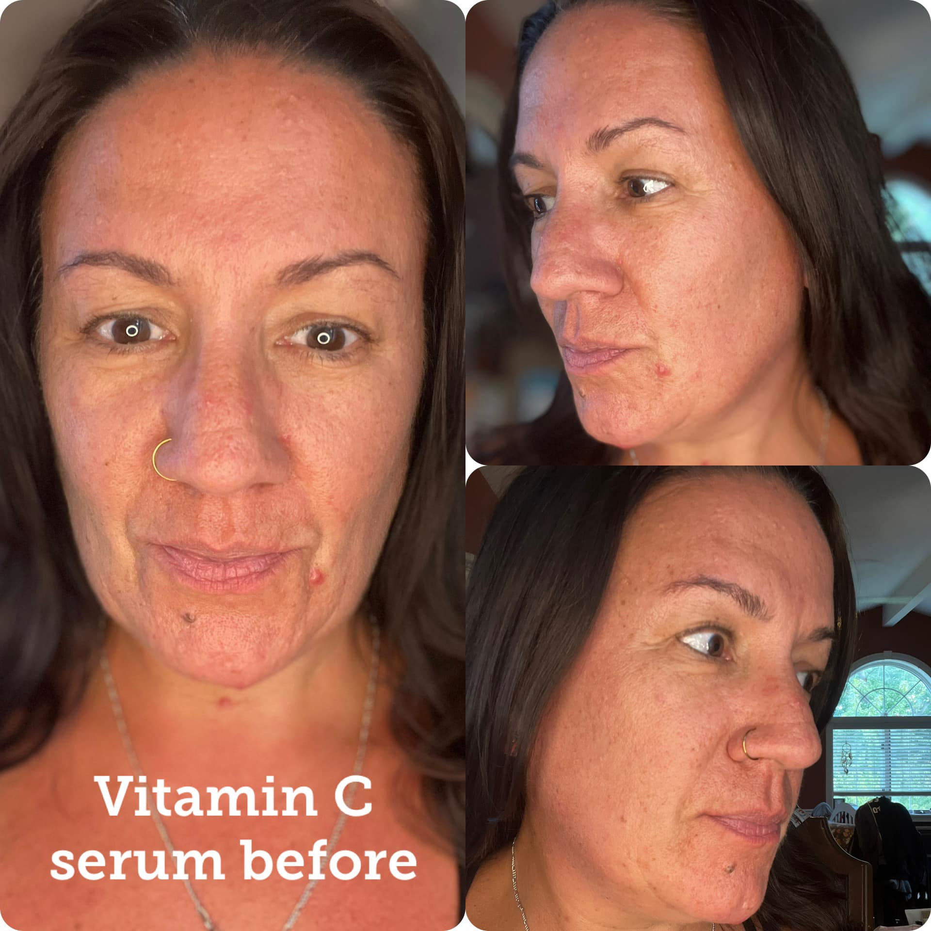 Vitamin C is considered a gold standard ingredient to maintain skin health. We took it one step further with our Gluta-Gold Smart C Complex. Encapsulated vitamin C with micro gold and glutathione