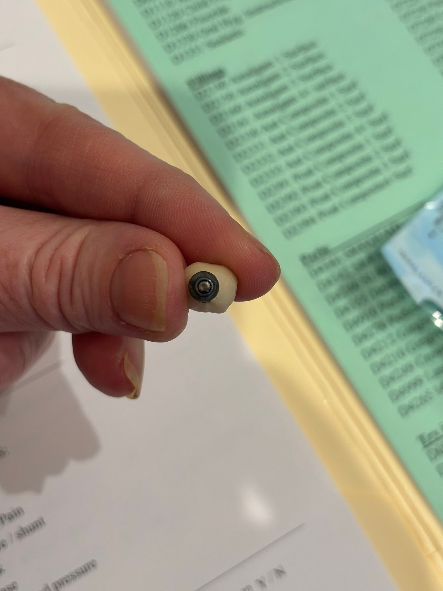 What brand is this dental implant?