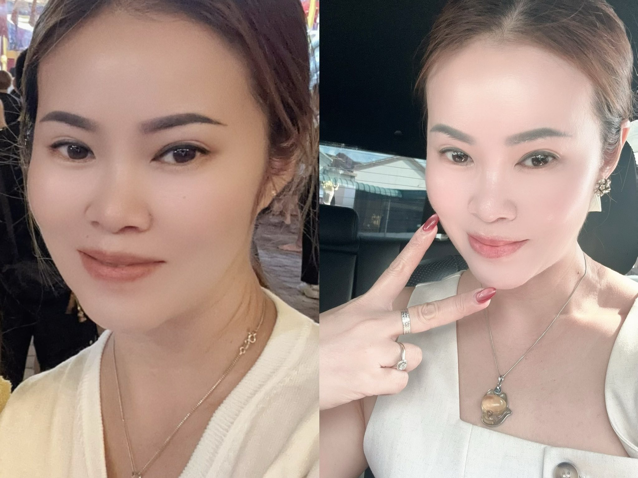 🌟 YIJIA MIRIKEL NMN18000 —— 科学焕活，时光倒流🌟 🕒 2分钟—— 身体