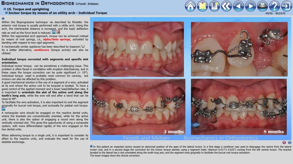 Orthodontic... - Orthodontic Biomechanics Summer School