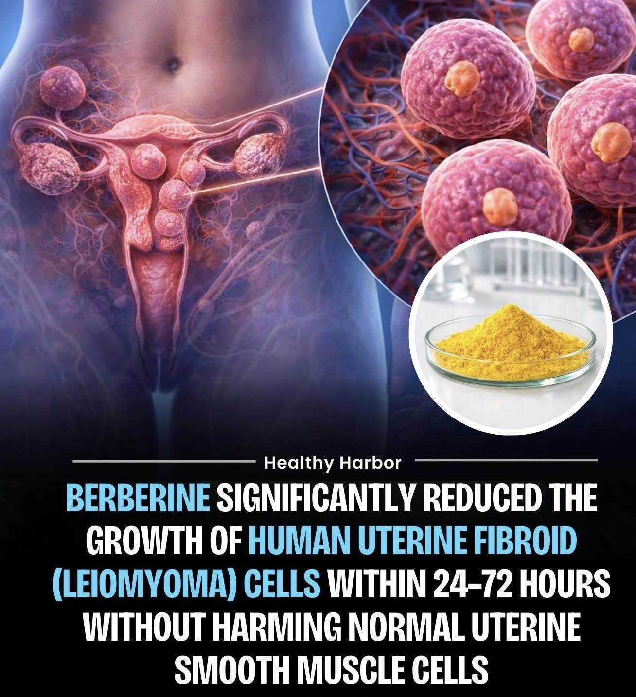 is glutathione good for fibroids A study published in Fertility and Sterility investigated the effects of berberine (BBR), a plant-derived alkaloid, on human uterine leiomyoma ( fibroid) cells and found that it significantly inhibits their proliferation. Conducted in Quantity:25 vials AHA BHA Body Lotion the best l-glutathione brand