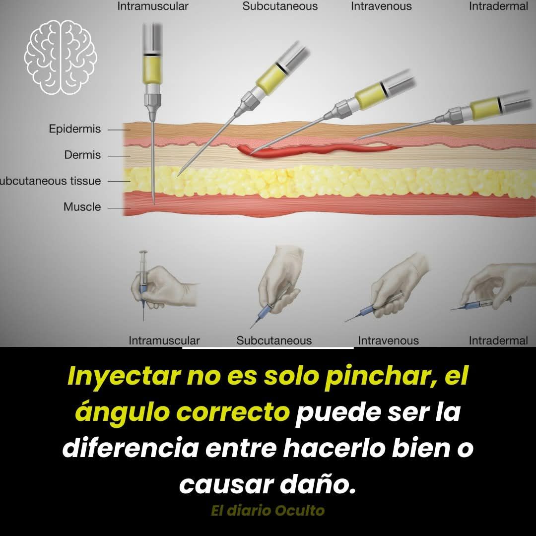 l carnitina dice intramuscular se puede poner subcutaneo Aprende a Administrar Inyecciones Subcutáneas de Forma Segura! 💉 Las inyecciones subcutáneas son una forma segura y efectiva de administrar medicamentos como insulina o anticoagulantes directamente en el tejido graso, no en Glutathione Injections in Mumbai value set flavor:Strawberry Kiwi