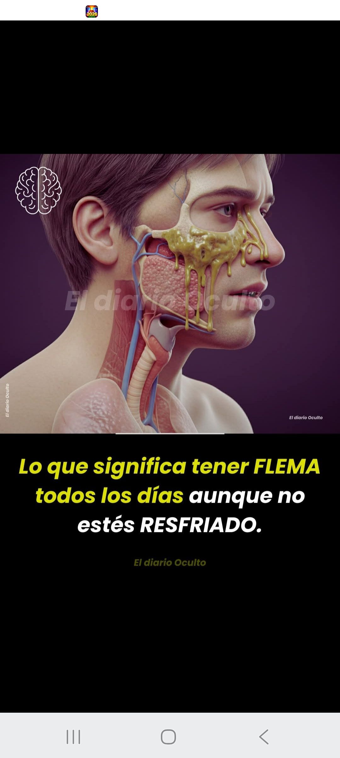 Lo que significa tener FLEMA todos los días aunque no estés RESFRIADO ...