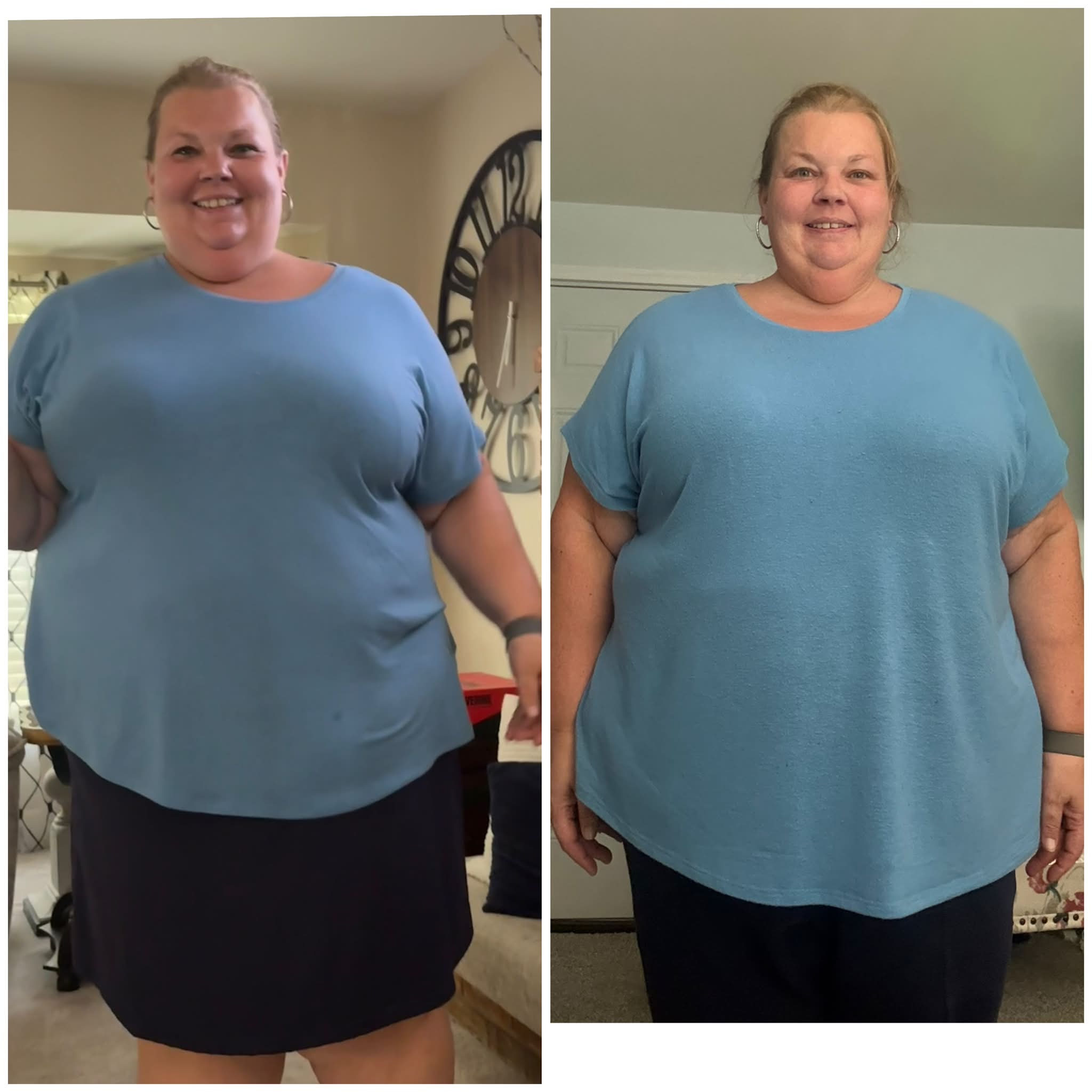 can i change my tirzepatide shot day injection site thigh: guide to proper technique and placement Best Day to Take Tirzepatide:
