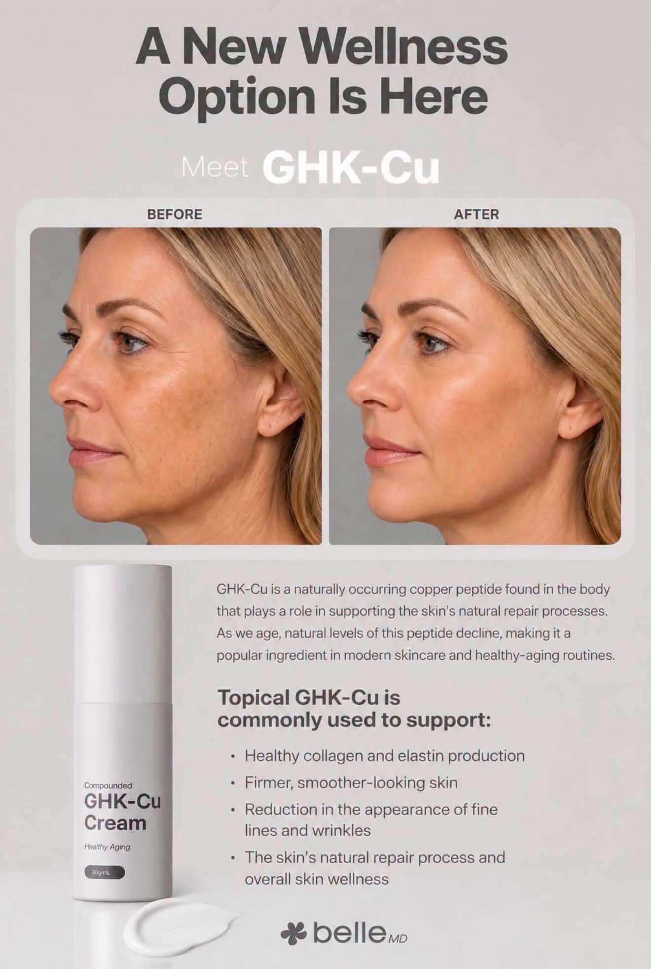 ghk-cu topical before and after Dawn Orlando, Florida Drug & glatathione Dosage:1mg (receptor grade)