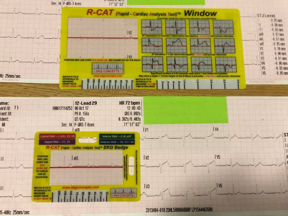 Medical - The #RCAT window is a unique tool for evaluating; Heart Rate ...