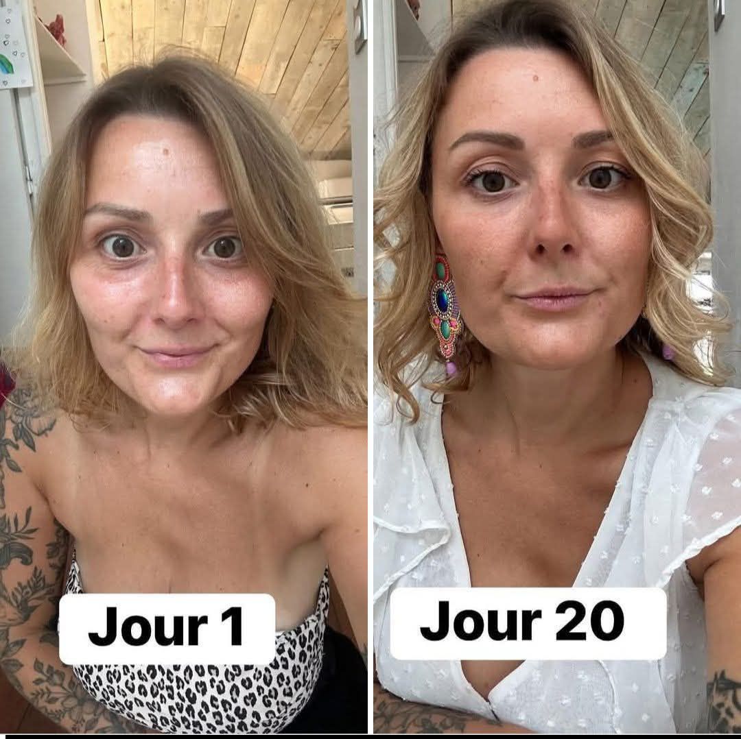 glutathion avant après 📲 Swipez le carrousel pour tout comprendre en 2 minutes ! 💬 Avez-vous déjà testé le dans votre routine ? Dites-le-moi en commentaire ! #PrettyPharmAdvisor #dzskincure #glutathione #lespetitsguides_byprettypharmadvisor #prettya Preventative Remedies