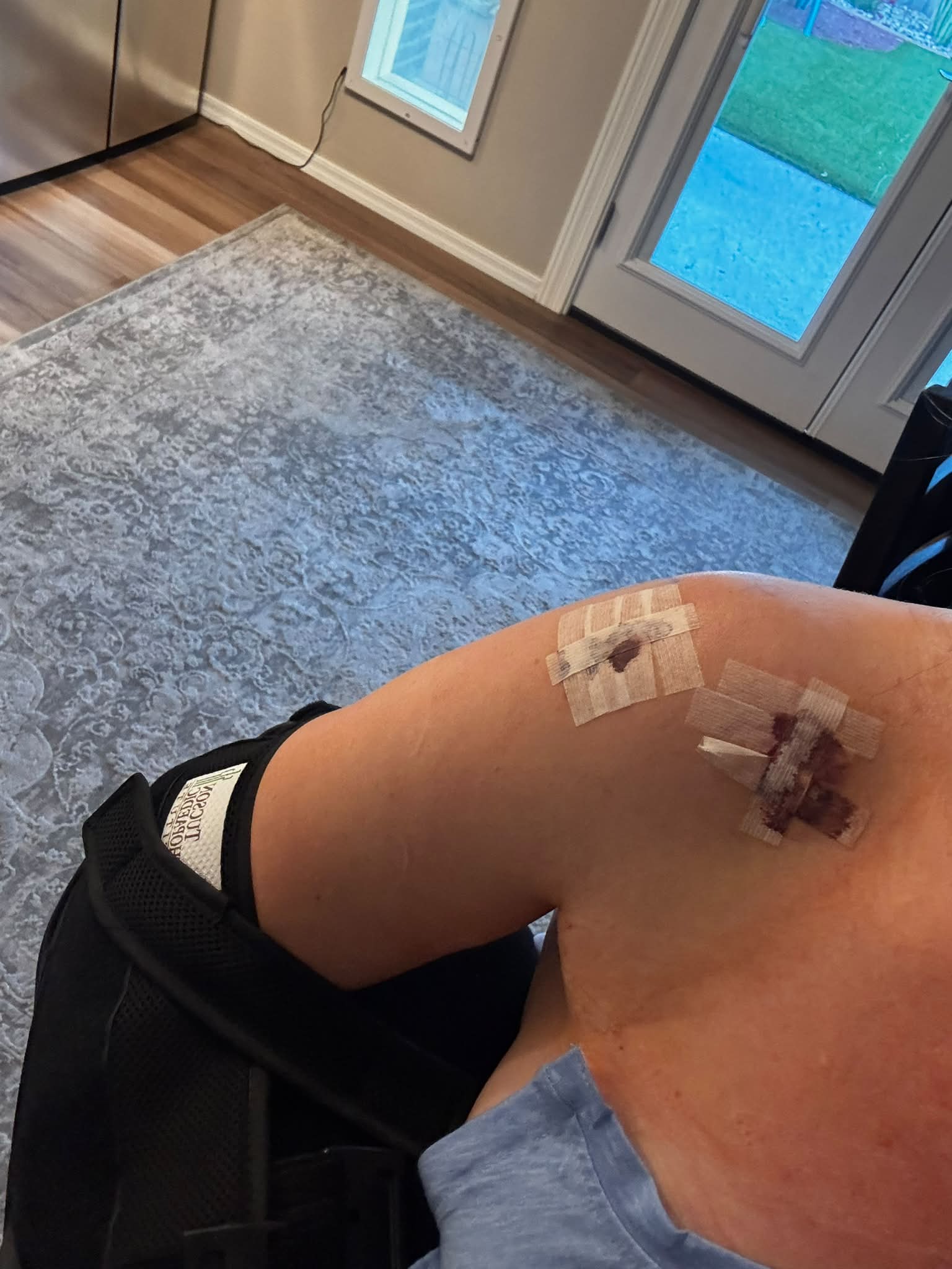 Bpc-157 tb-500 for rotator cuff surgery recovery