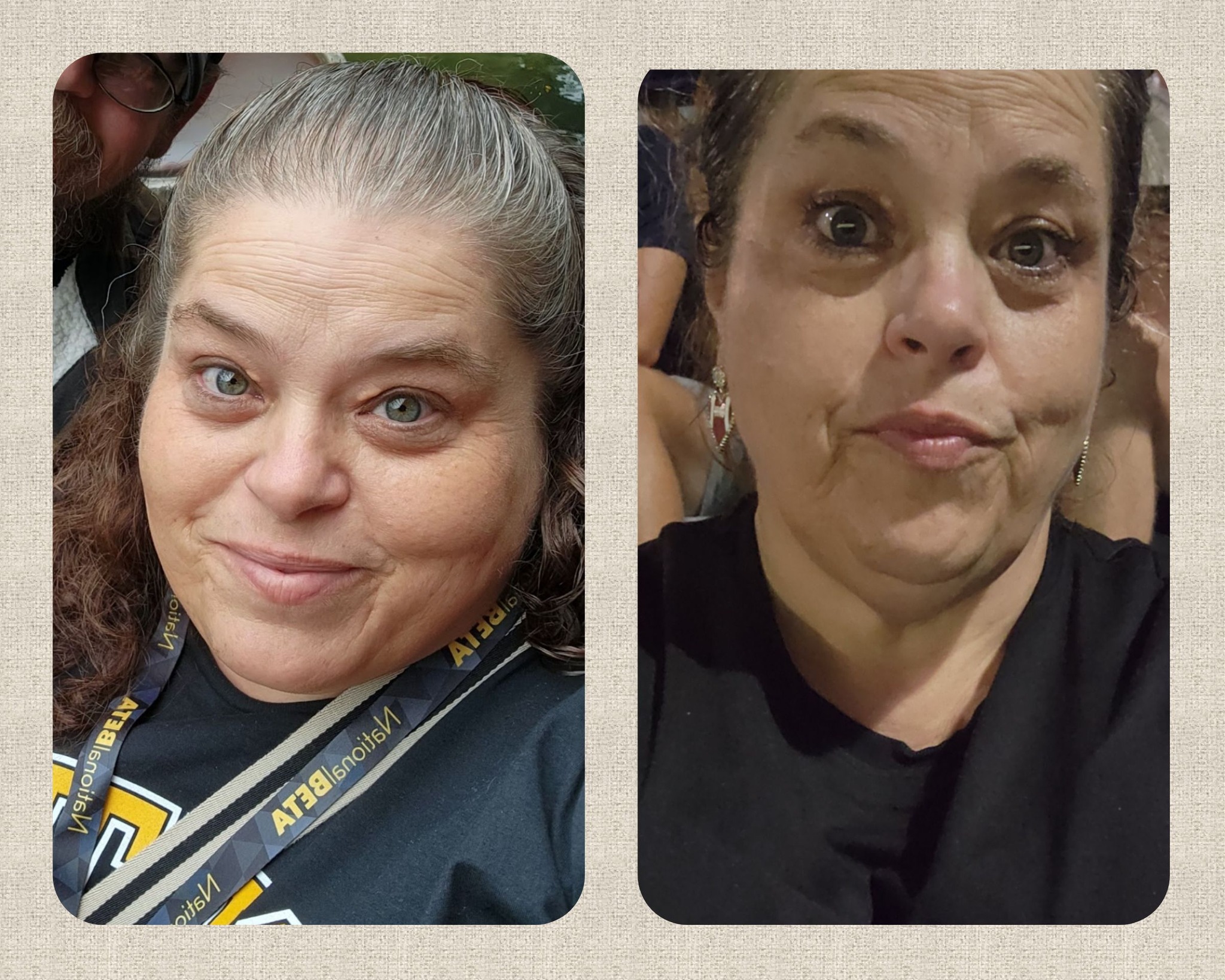 Is it just me, or is anyone else always cold since weight loss with zepbound/glp-1s?