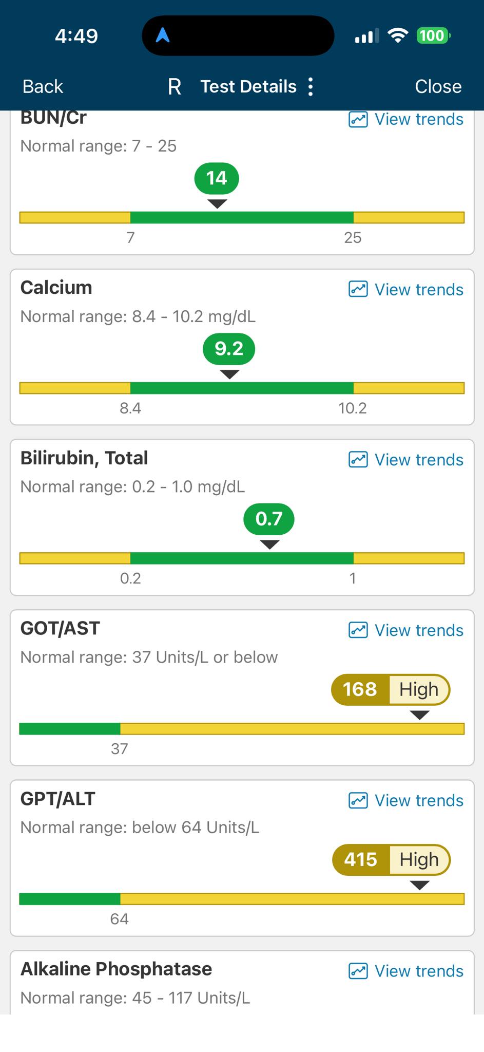 Zepbound user experiences abnormal liver test results after 18 months