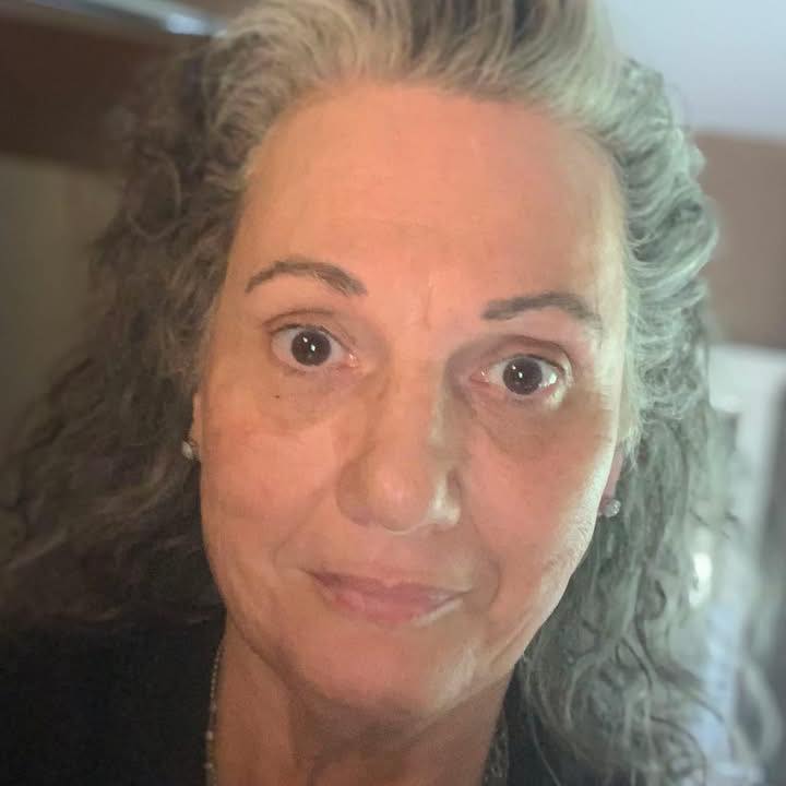 Shared a pic of my rash on Chat GPT,... - Donna Lucier Scully | Facebook