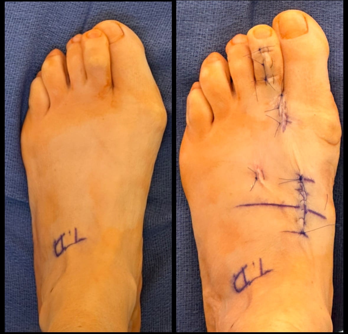 North Texas Foot and Ankle Specialists, P.C. | Denton TX