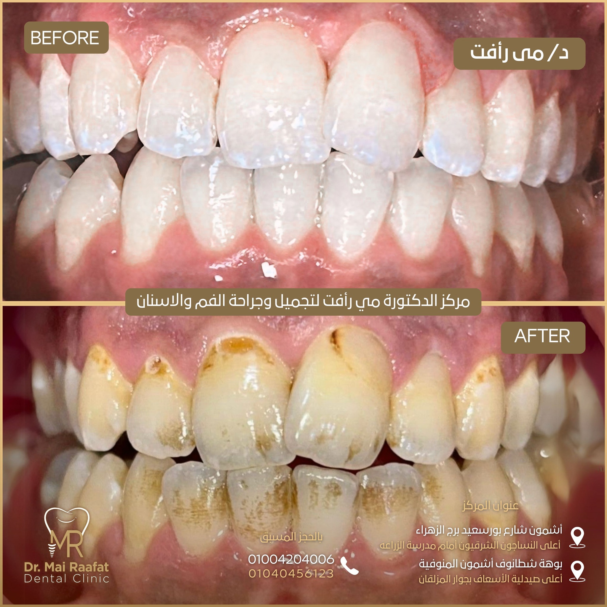 Dr. Mai Rafaat Dental Clinic | Ashmun