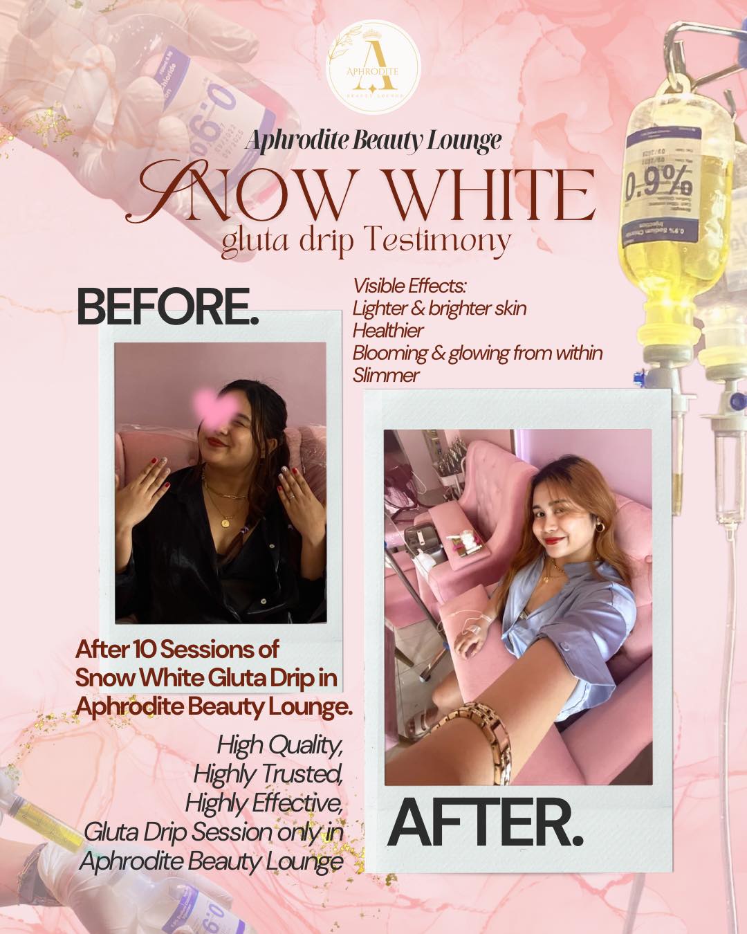 snow white glutathione drip IV Therapy in NYC: How the Snow Drip Brightens Skin Tone Snow White Gluta Drip Our