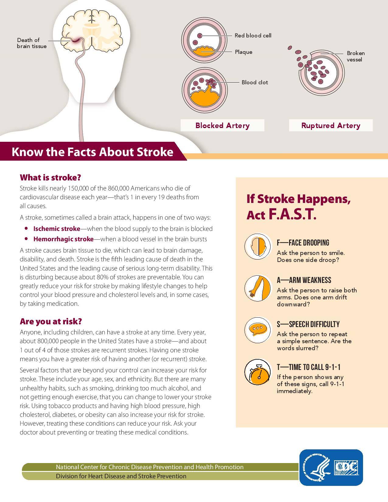 Neurology UPM - Did you know that.. Stroke is the second...