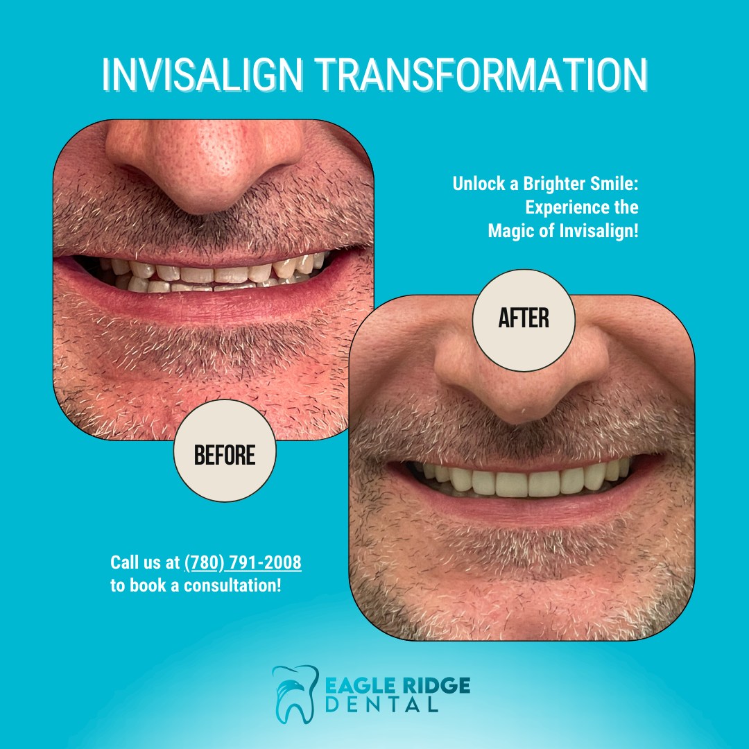 🎉 Smile with confidence! This... - Eagle Ridge Dental Clinic | Facebook