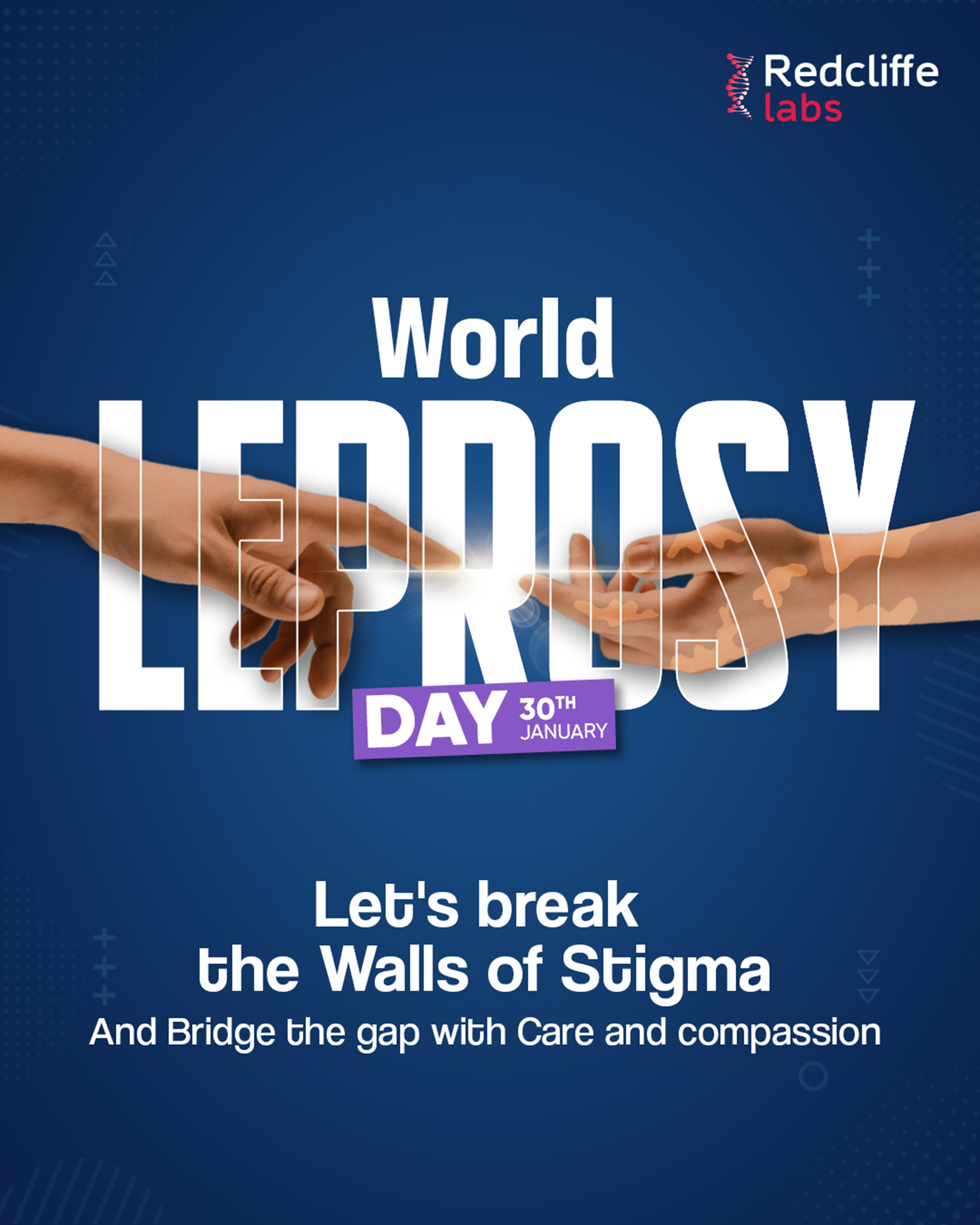 World Leprosy Day is celebrated under the theme 