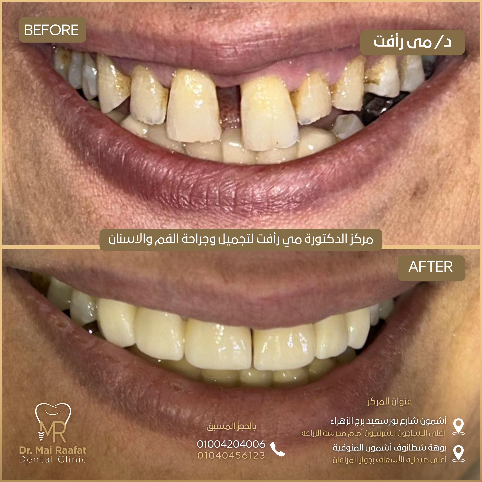 Dr. Mai Rafaat Dental Clinic | Ashmun
