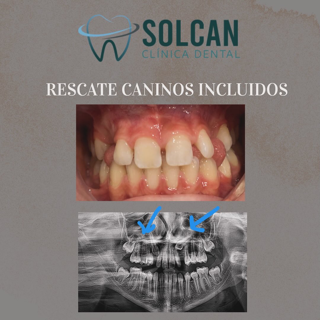 Solcan Dental - ¿Qué hacer cuando los dientes no... | Facebook