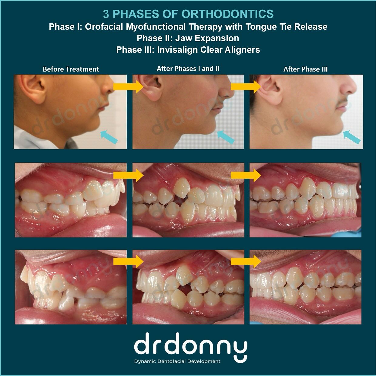 Dr Donny - THRIVE IN THREE Every now and then, 3 phases... | Facebook