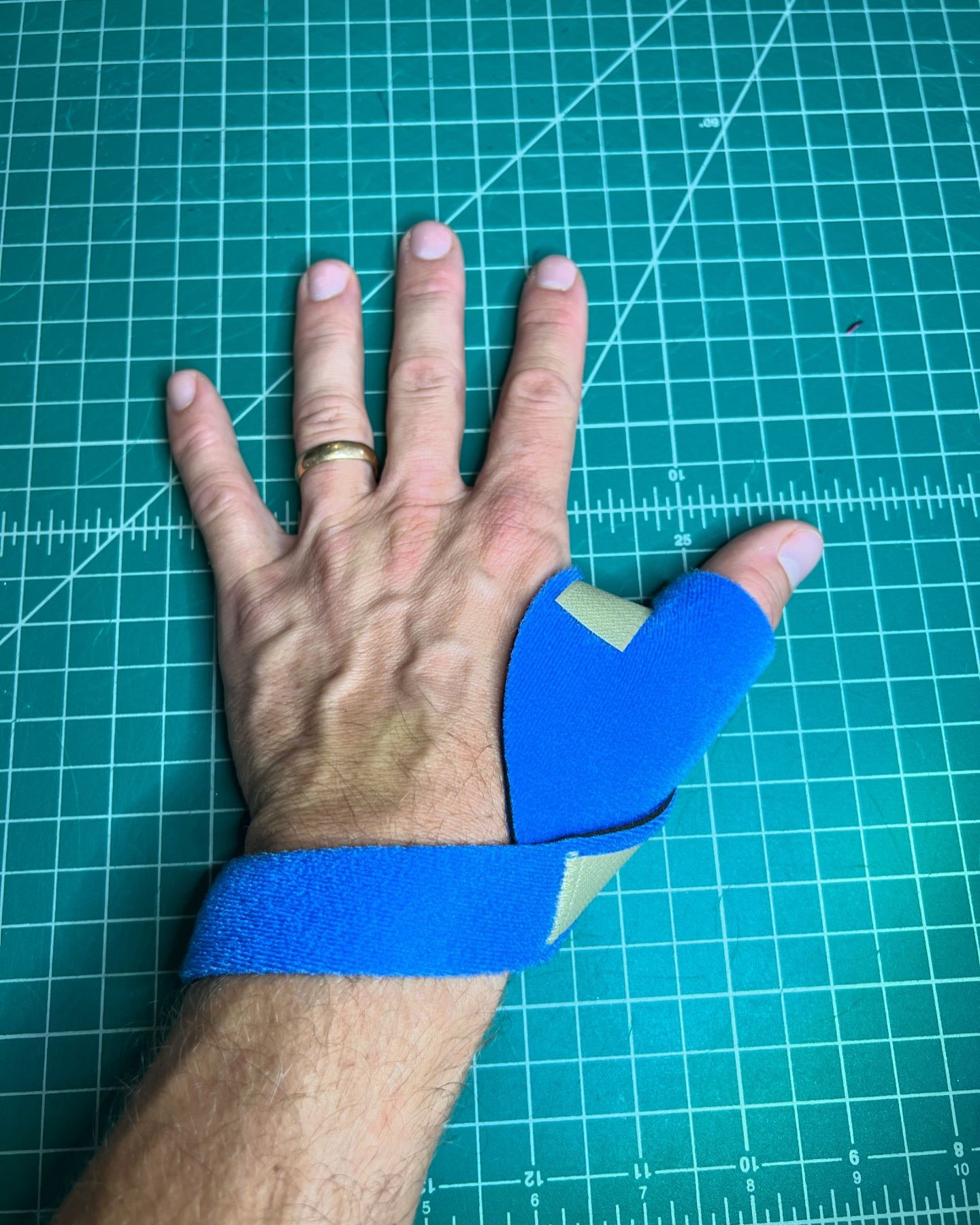 Mckie Splints | Duluth MN