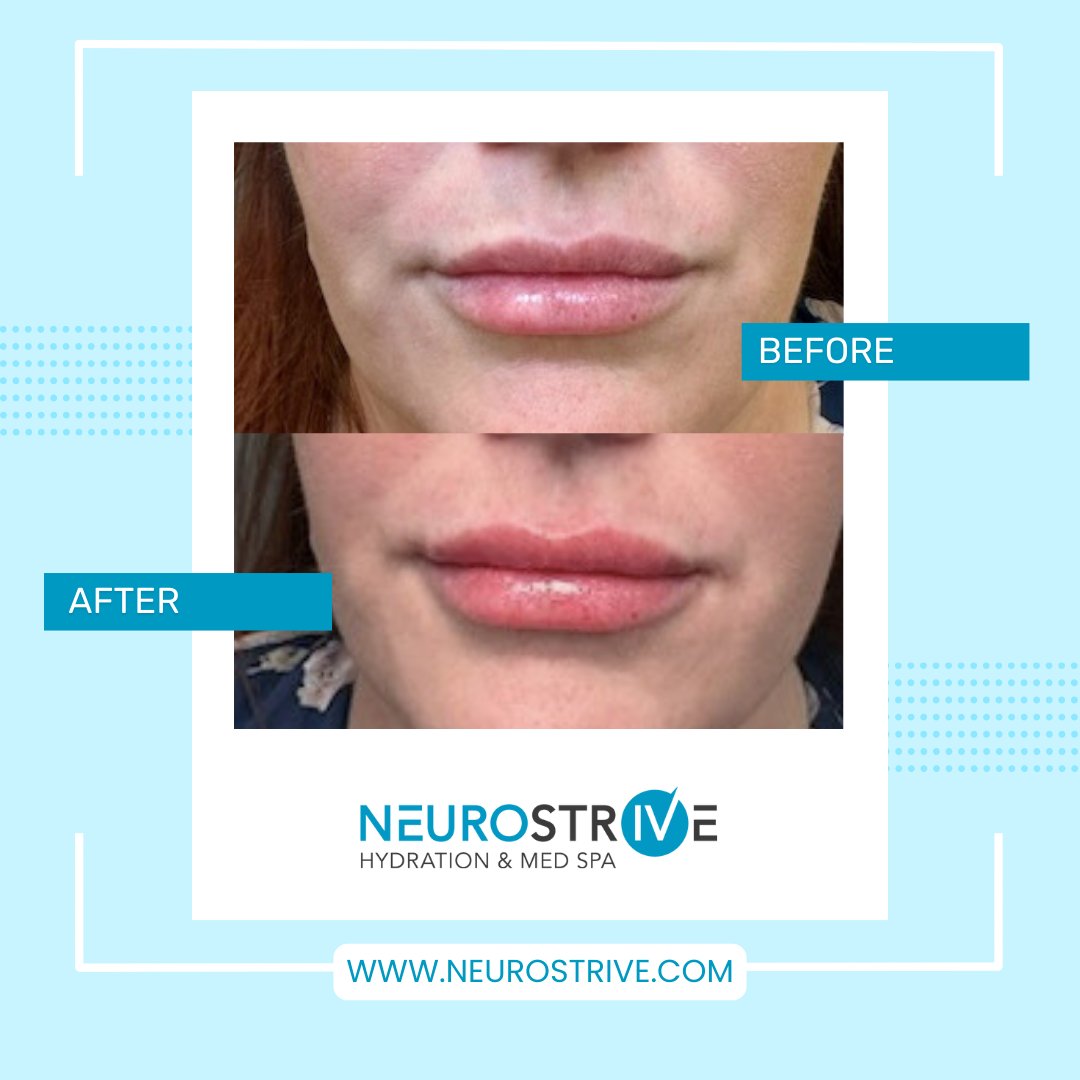 💋 Ready to enhance your... - Neurostrive Hydration & Med Spa | Facebook