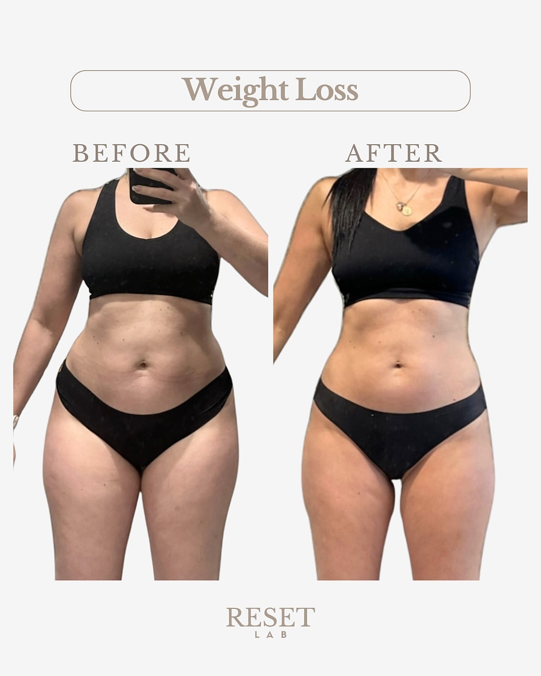 GLP-1 Before & After Reset Lab 💉 Real Results with Tirzepatide, L-Carnitine & Lipostat This client lost nearly 30 pounds — going from 163.7 lbs to 135.1 lbs — with the help