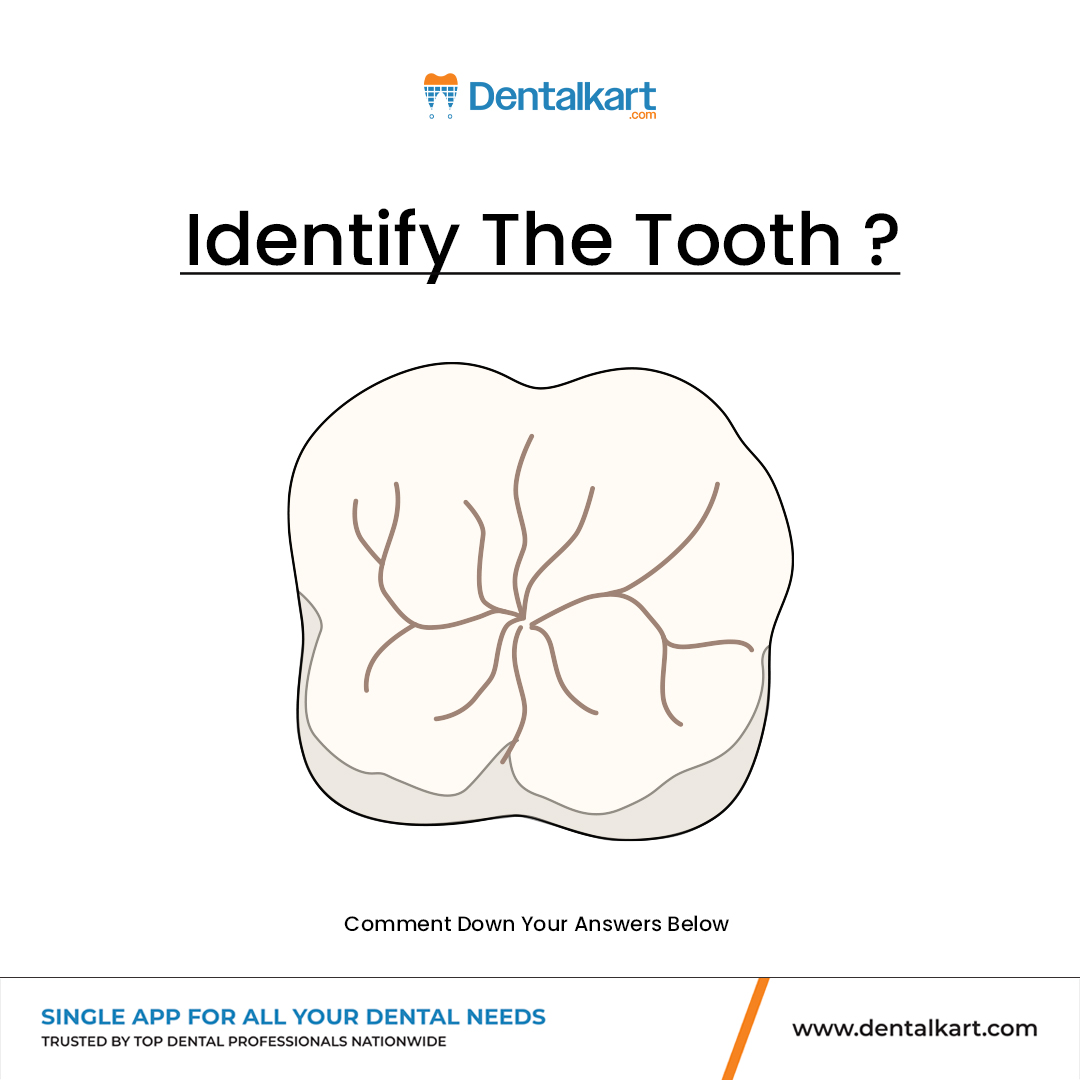 DentalKart - 🦷 Guess the Tooth! 🦷 Can you identify this tooth just by ...