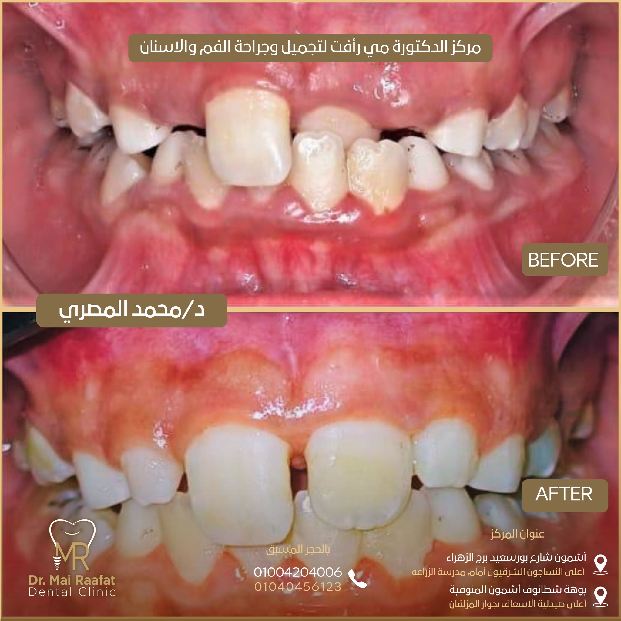Dr. Mai Rafaat Dental Clinic | Ashmun