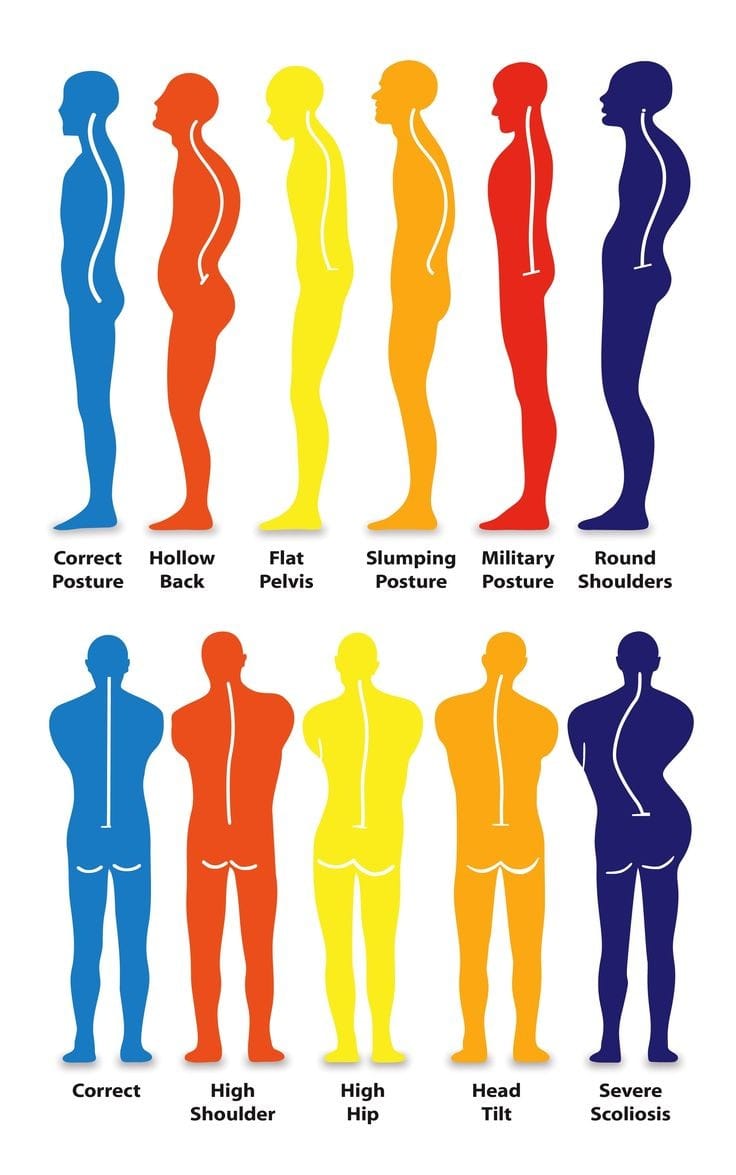 Human Anatomy Group | Types of postures #biomechanics #posture # ...