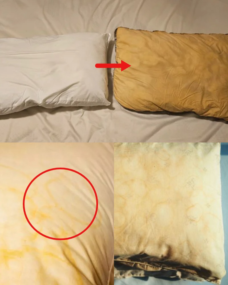 Women - If your pillows turns yellow, act quickly! Because it means ...