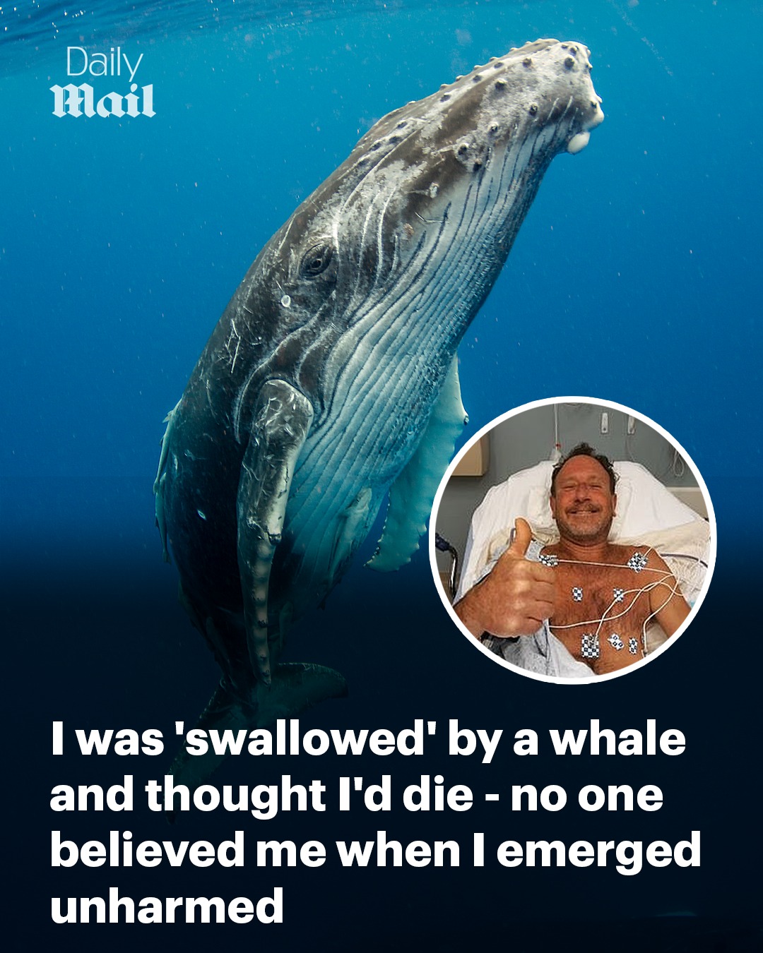 Daily Mail Video - His story baffled doctors 😱 Read more: https://trib ...