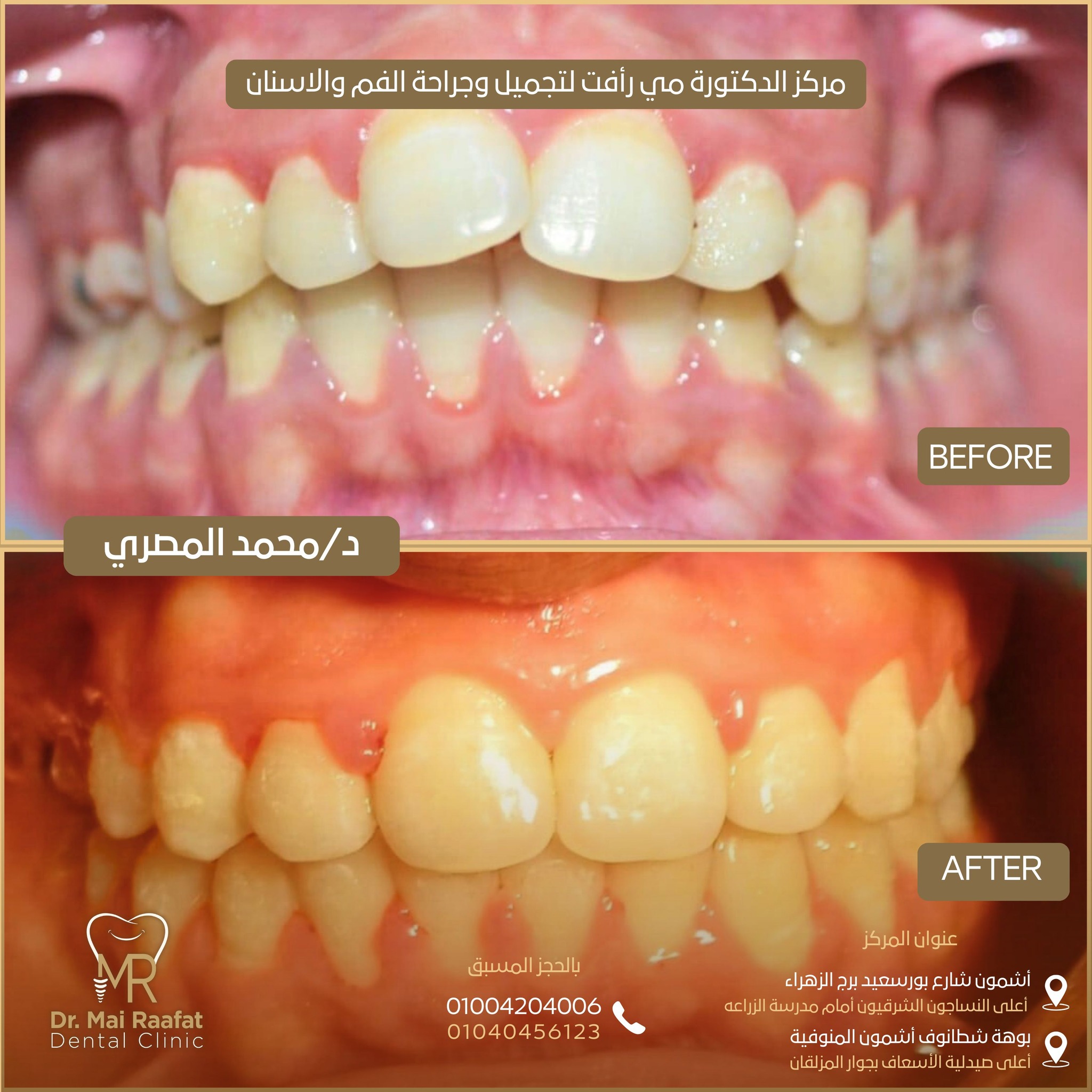 Dr. Mai Rafaat Dental Clinic | Ashmun