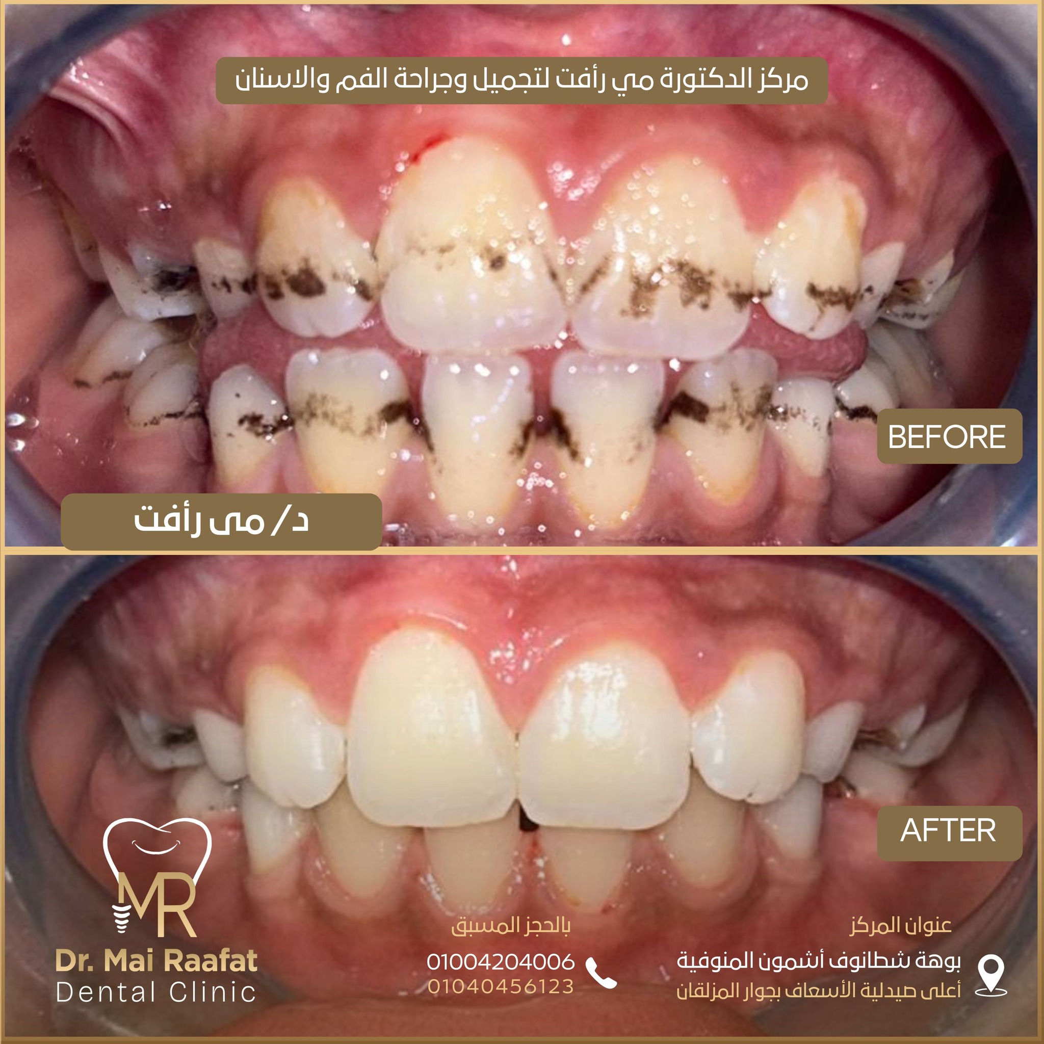 Dr. Mai Rafaat Dental Clinic | Ashmun