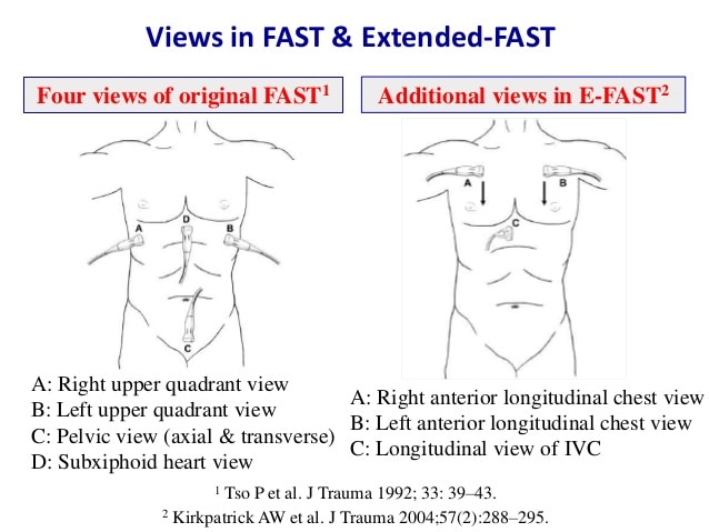 Focused assessment with... - كل يوم معلومة جراحية - ليبيا