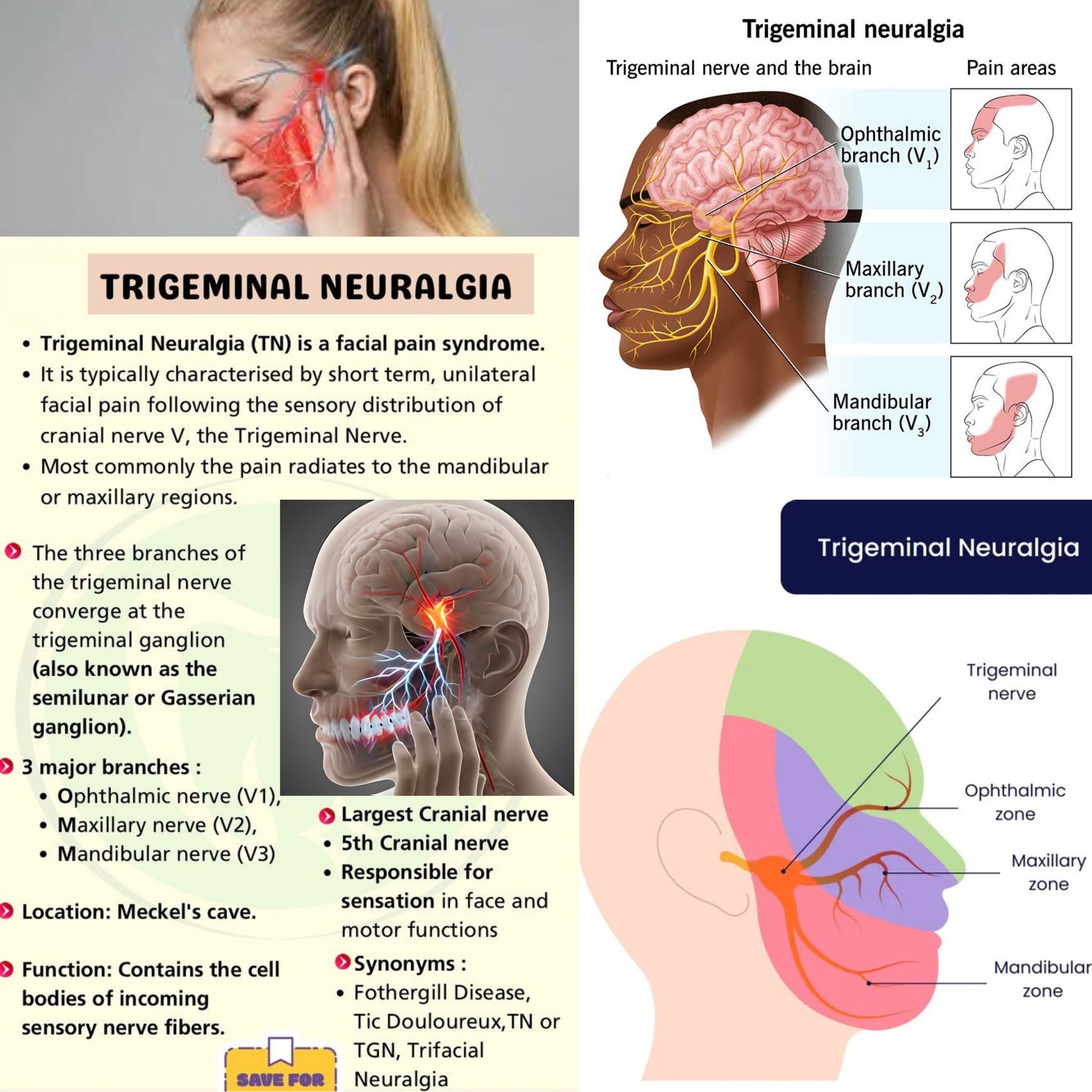 b12 injections for trigeminal neuralgia Sudden, electric-shock facial pain?⚡It could be neuralgia, a condition affecting the nerve that controls feeling in your face. Even simple things like talking, chewing, or brushing your teeth can trigger intense support sensory wellness Animal_Cattle Specification:2cc                                     50 Amp / Box Copper Peptide Scalp Care