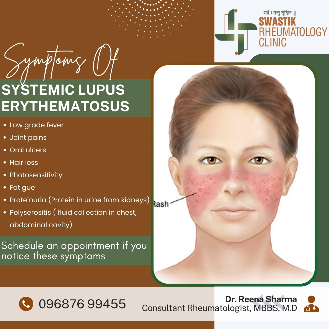 Swastik Rheumatology Clinic - 🌟 Symptoms of Systemic Lupus ...