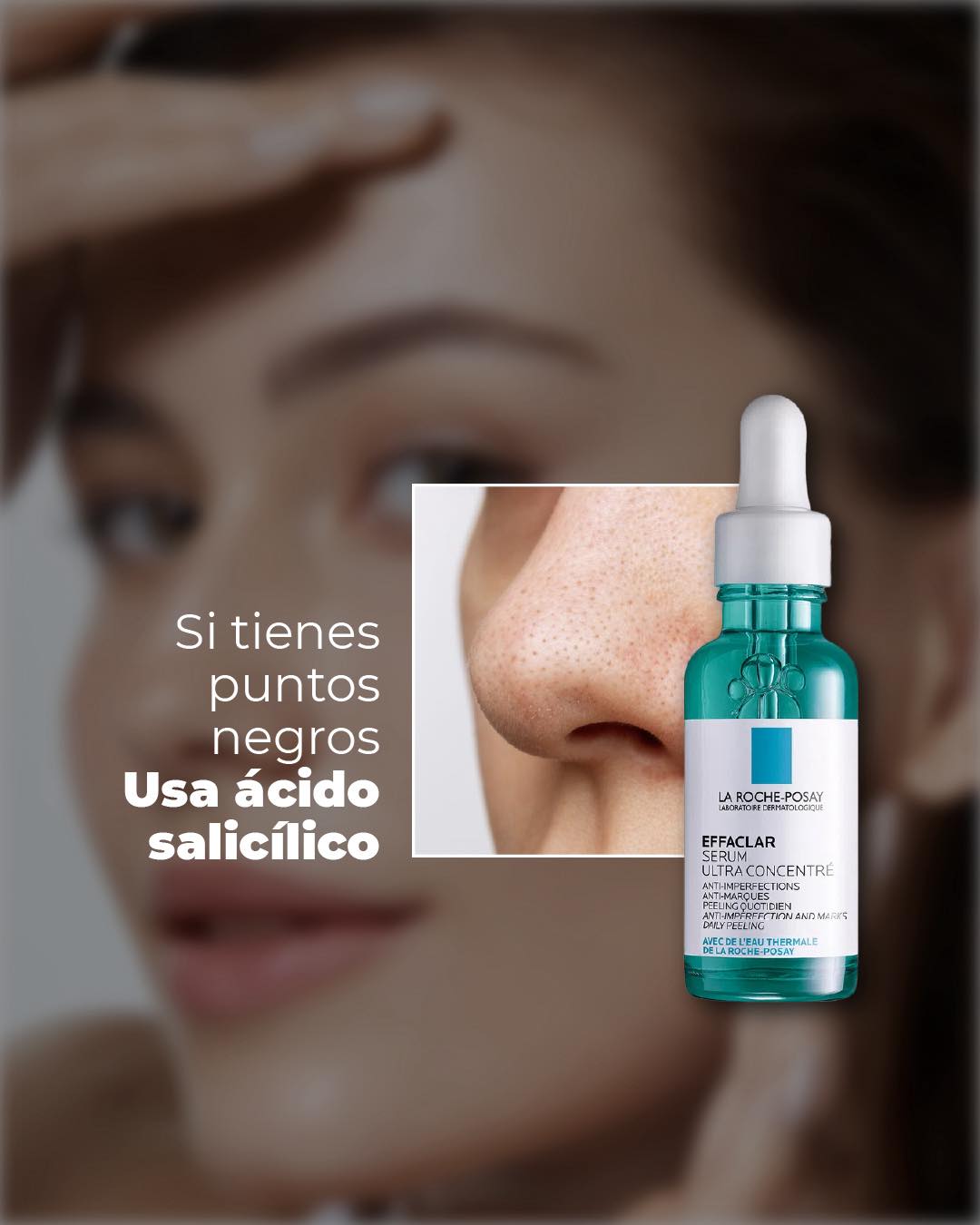 Dermalife - Su uso es perfecto para cuando tu piel está irritada ...
