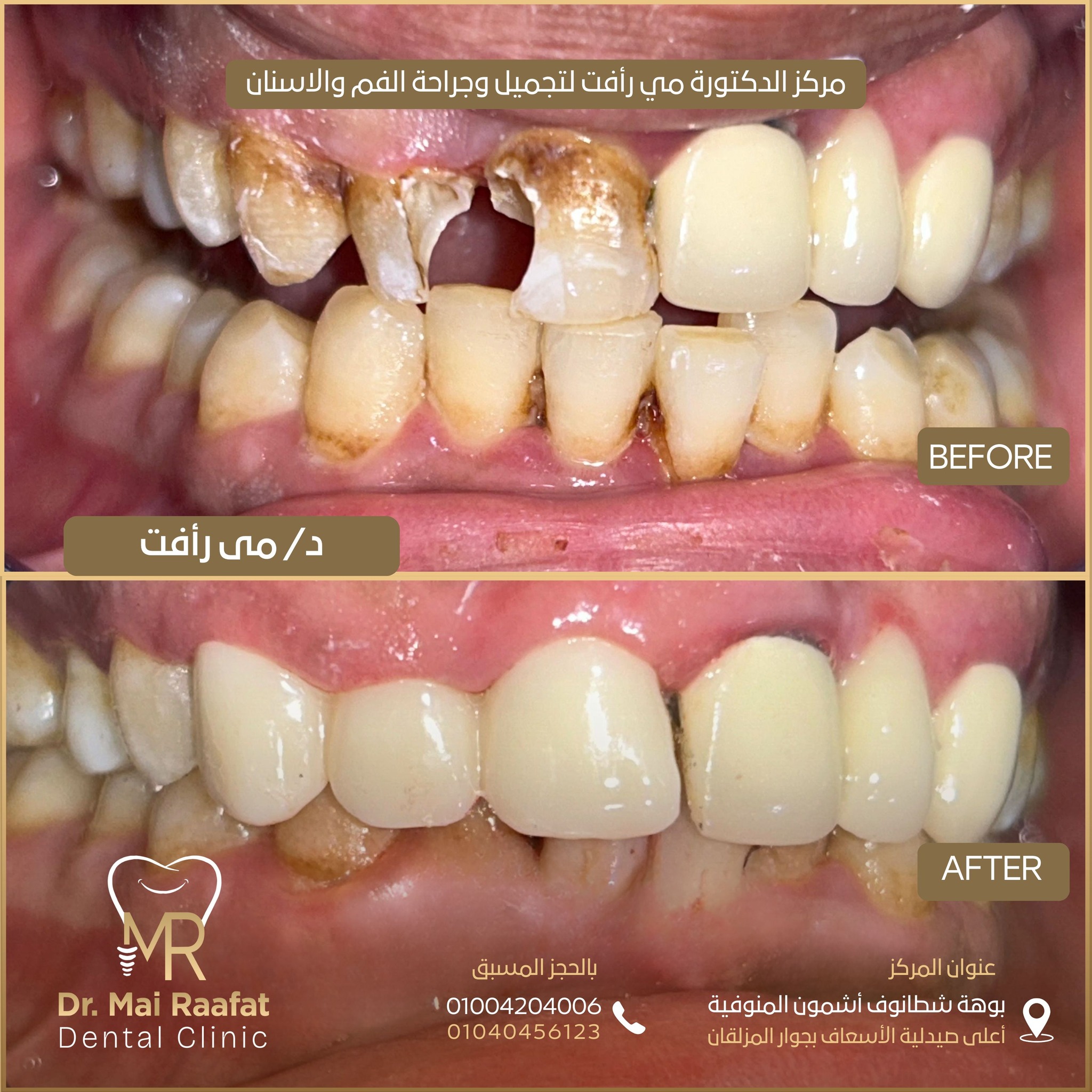 Dr. Mai Rafaat Dental Clinic | Ashmun