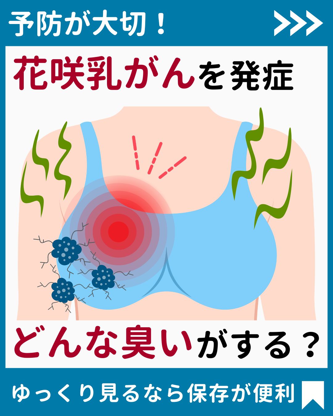 花咲 が ん