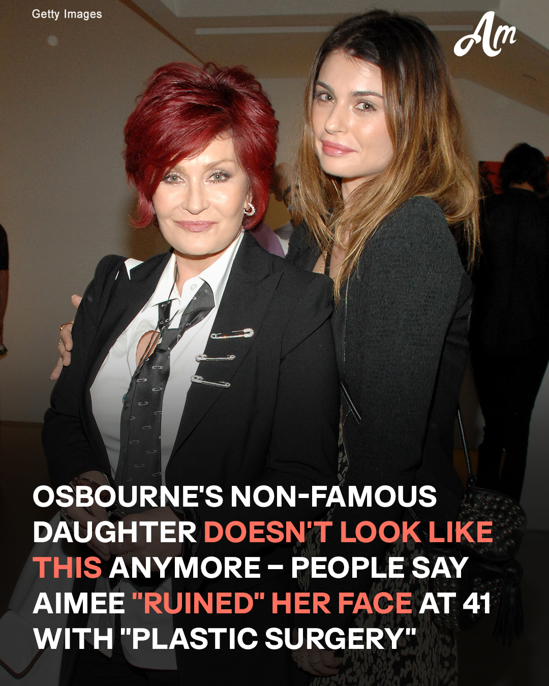 aimee osbourne plastic surgery Image 3
