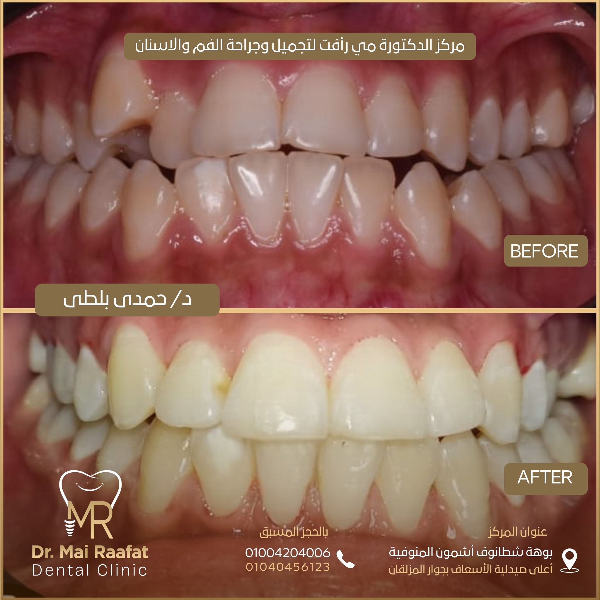 Dr. Mai Rafaat Dental Clinic | Ashmun