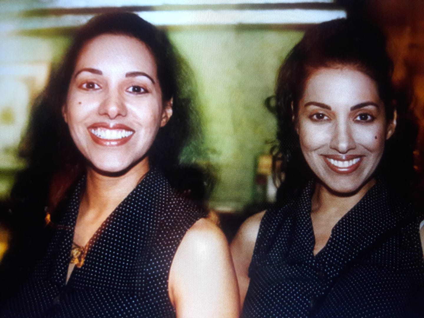 Neena And Veena (Belly Twins) | Facebook