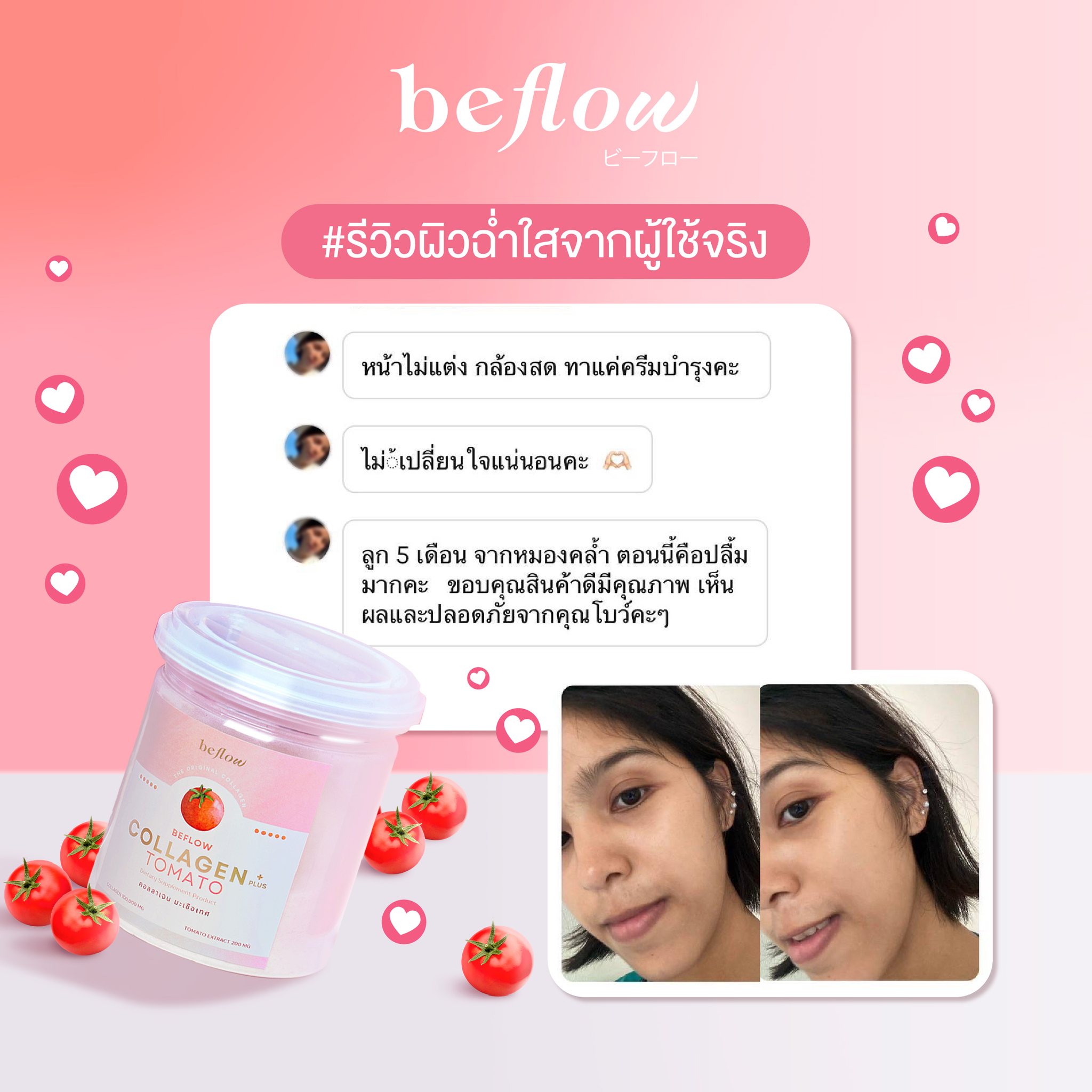 Beflow collagen : ປະເທດລາວ