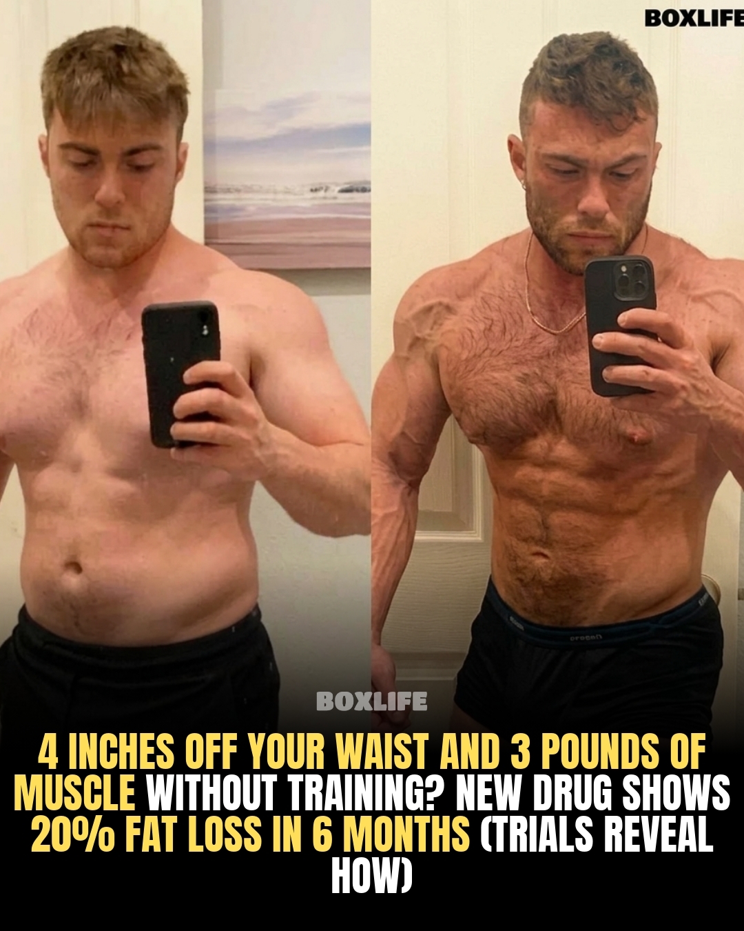 Combined use of semaglutide with an investigational monoclonal antibody called bimagrumab produced significant fat mass loss while preserving lean mass, results from the phase 2b BELIEVE study found. http://ms.spr.ly/6180SLSUq