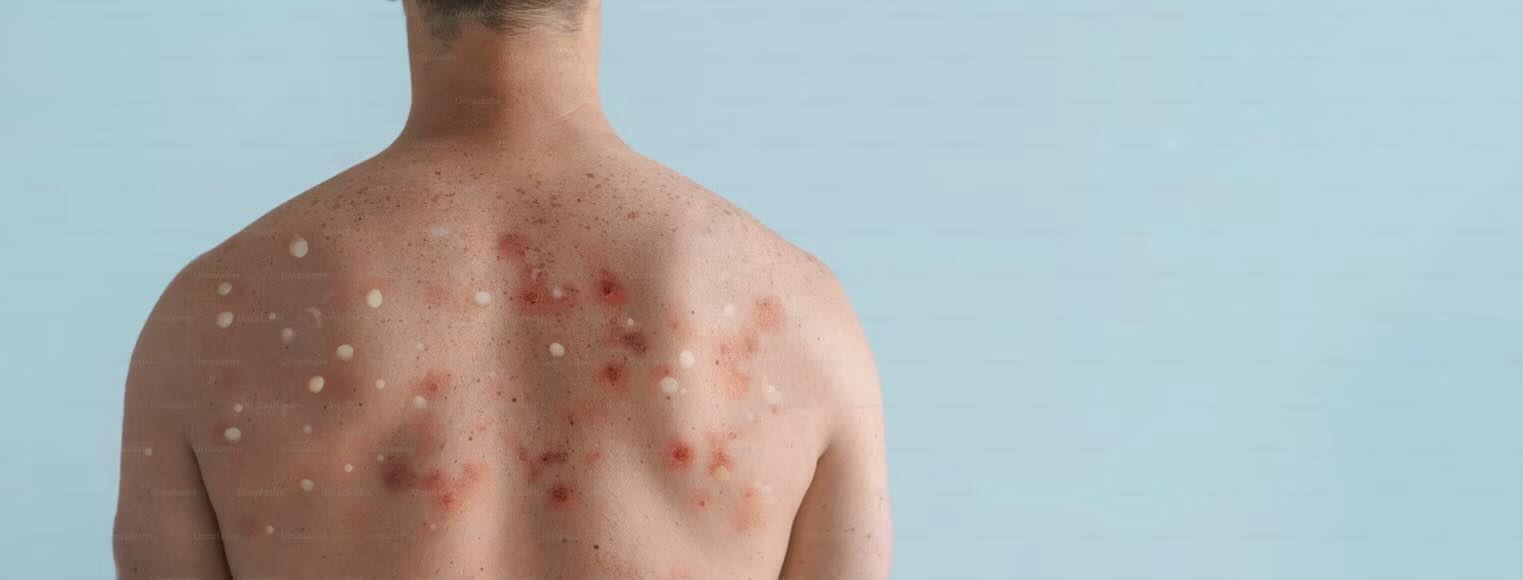 b12 injection allergic reaction How does everyone handle and allergy injections in their offices? Size:Discovery Size (10 mL) Vitamin B12 Injection at Best Seller