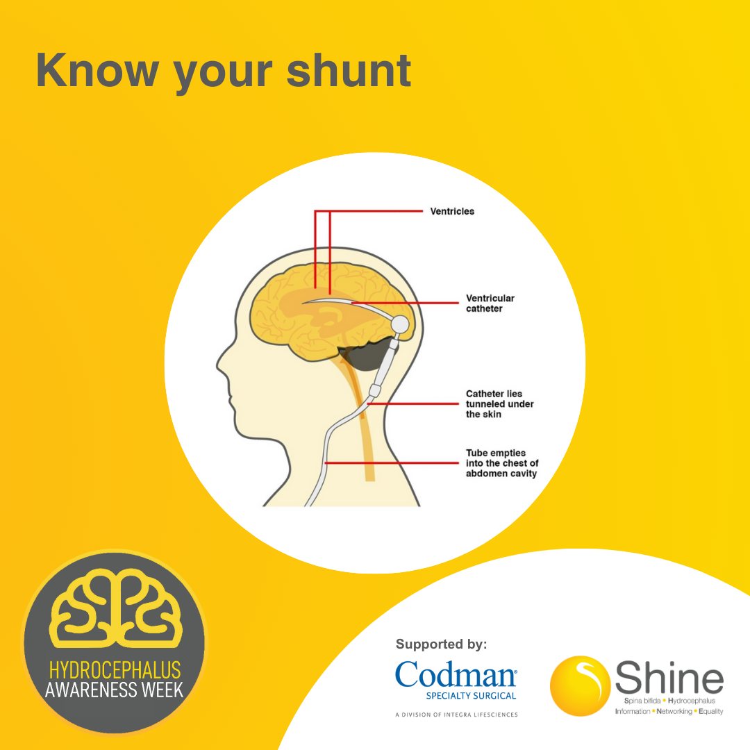 Shine - Do you know your #shunt? For those #LivingWithHydrocephalus ...