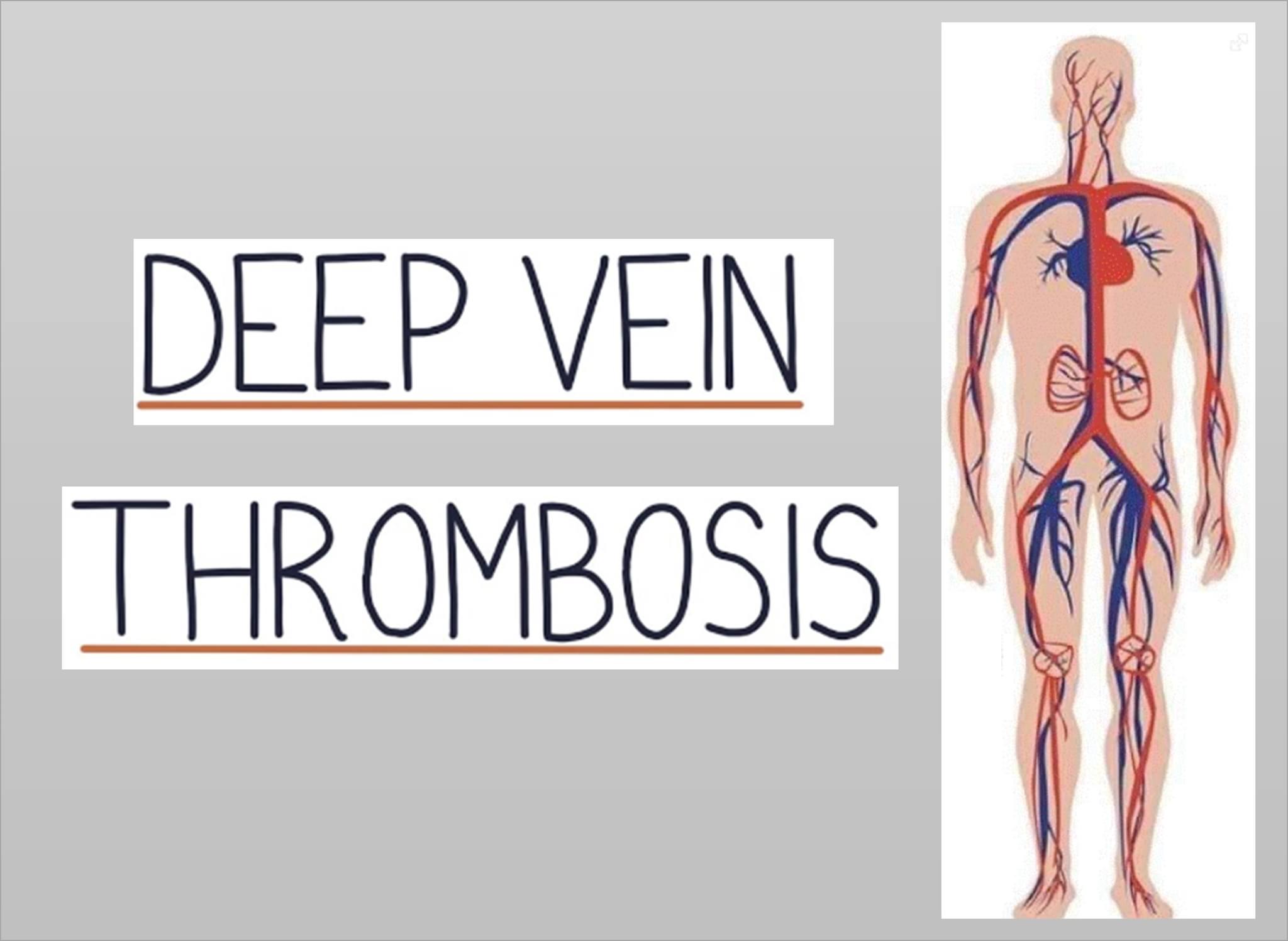 The Rane Center - WHAT IS A DVT? DVT is the abbreviation... | Facebook