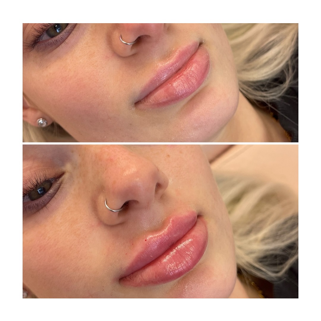 Paton Cosmetic Injectables | Pakenham VIC